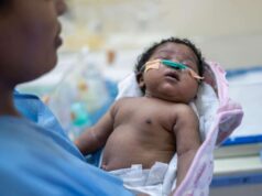 Un bébé opéré avant la naissance par un chirurgien nigérian, pionnier de la chirurgie prénatale